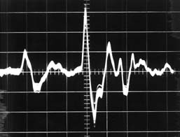 Dan Gibson Parabolic Mic  14kb
